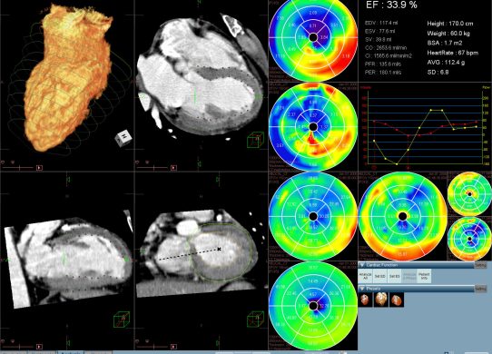 Cardiovascular Image Analysis Software Market