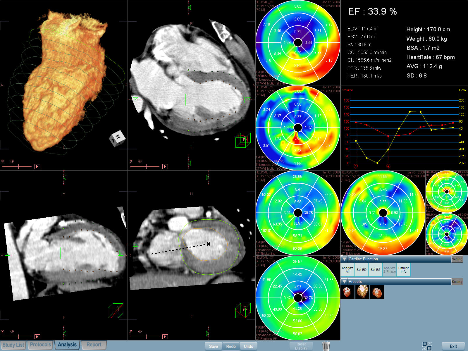 Cardiovascular Image Analysis Software Market